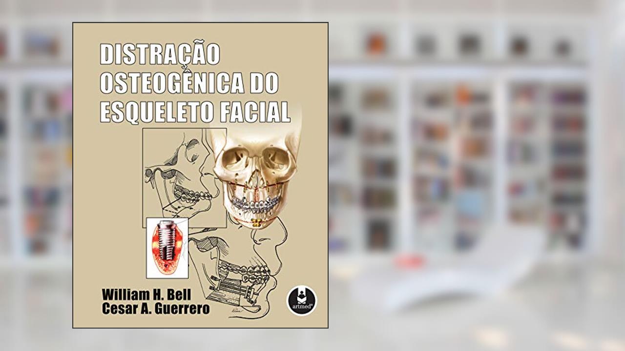 Capa de Distração Osteogênica do Esqueleto Facial, do autor William H. Bell; Cesar A. Guerrero