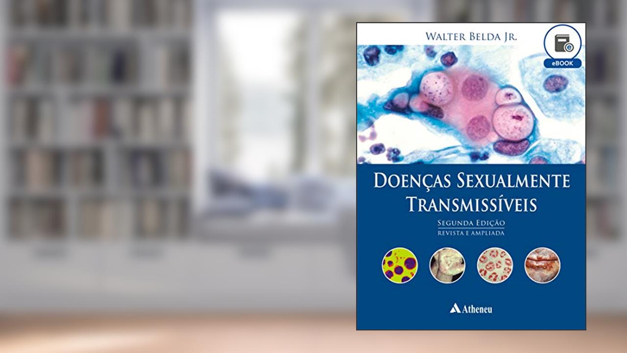 Capa de Doenças Sexualmente Transmissíveis - 2ª Edição (eBook), do autor Walter Belda Júnior