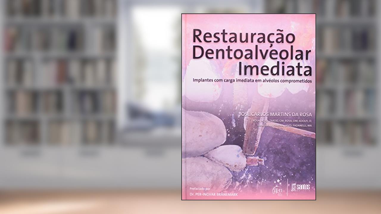 Capa de Restauração Dentoalveolar Imediata - Implantes com Carga Imediata em Alvéolos Comprometidos, do autor José Carlos Martins da Rosa