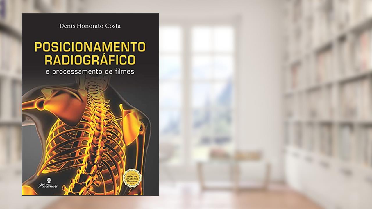 Capa de Posicionamento Radiográfico e Processamento de Filmes, do autor Denis Honorato Costa
