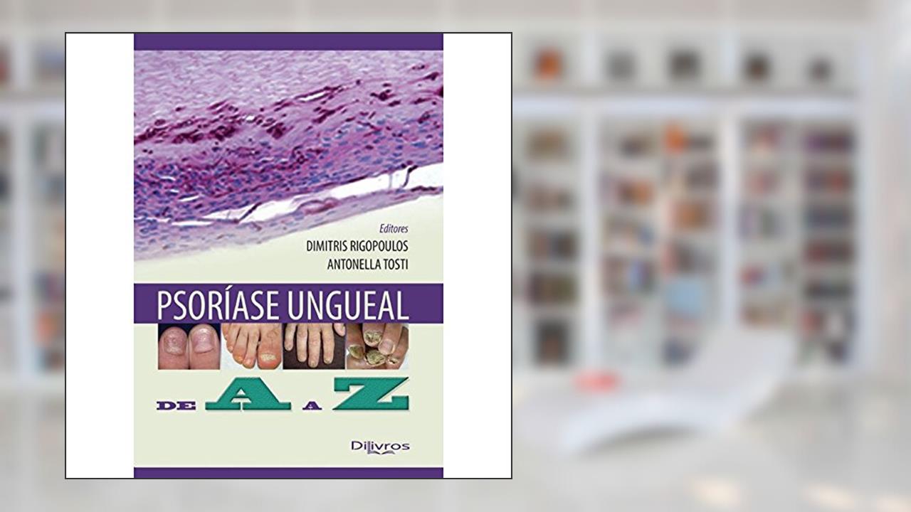 Capa de Psoríase Ungueal: De A a Z, do autor Dimitris Rigopoulos