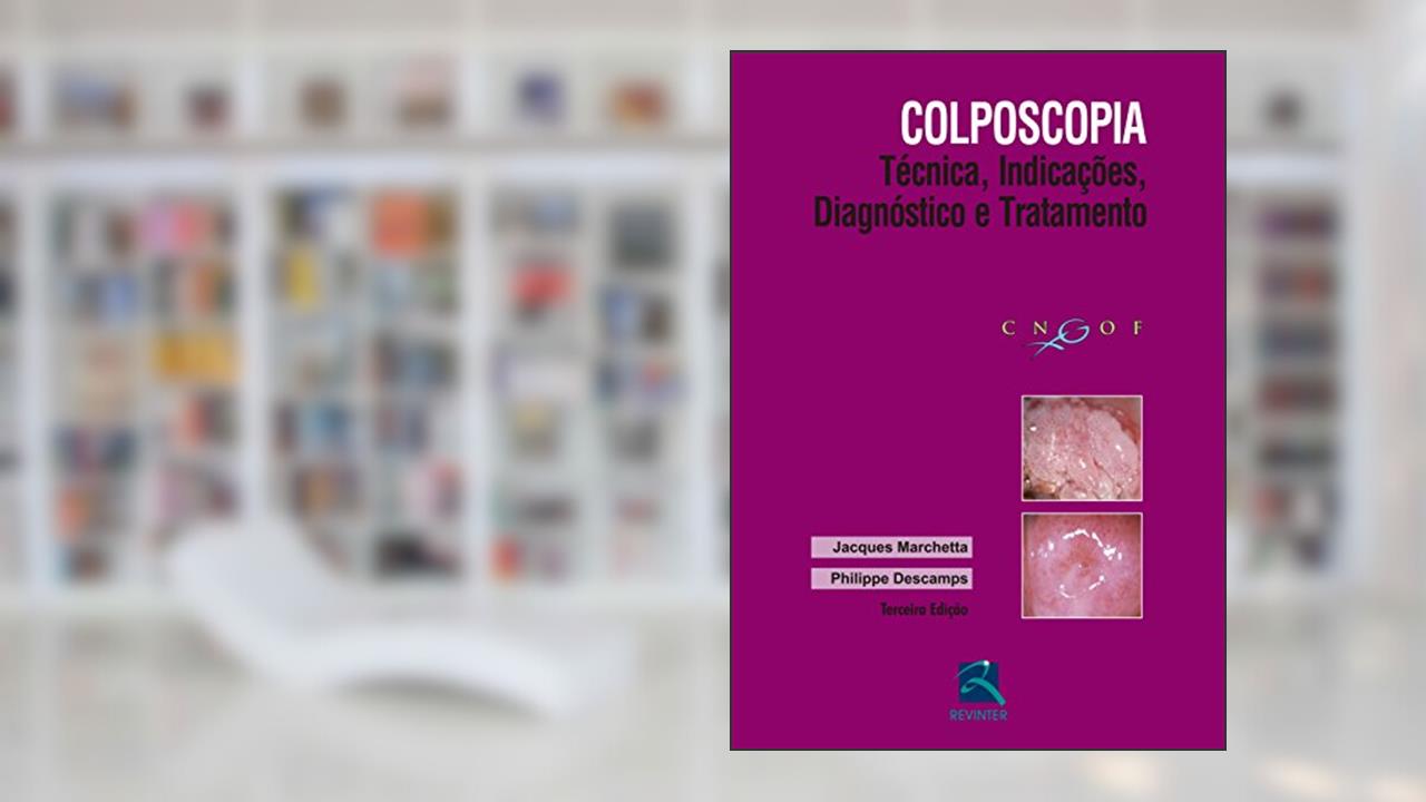 Capa de Colposcopia: Técnica, Indicações, Diagnóstico e Tratamento, do autor Jacques Marchetta
