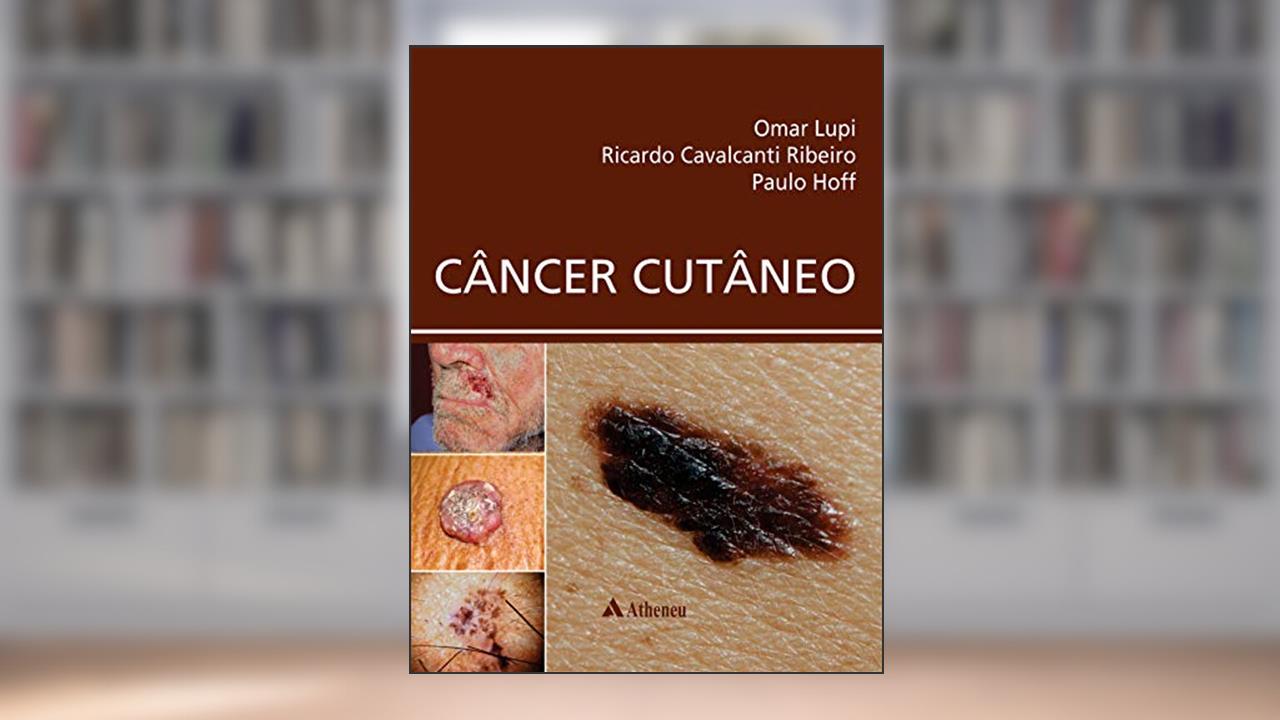 Capa de Câncer Cutâneo, do autor Ricardo Cavalcanti Ribeiro; Paulo M. Hoff Omar Lupi