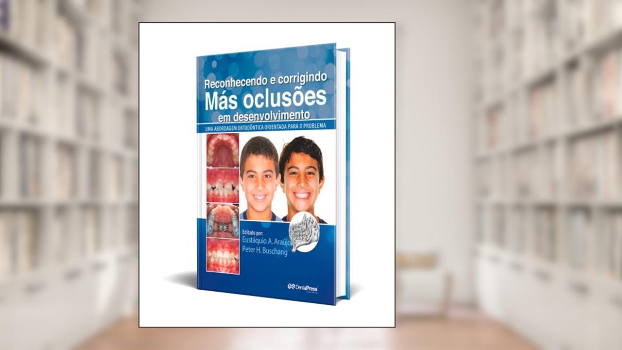 Capa de Reconhecendo e Corrigindo Más Oclusões em Desenvolvimento. Uma Abordagem Ortodôntica Orientada Para o Problema, do autor Eustáquio Afonso Araújo