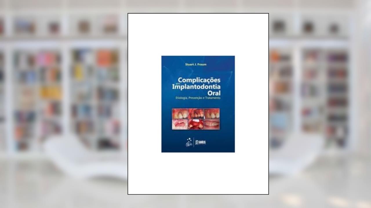 Capa de Complicações em Implantodontia Oral - Etiologia, Prevenção e Tratamento, do autor Stuart J. Froum