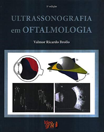 Ler Ultrassonografia em Oftalmologia, do autor Valmor Ricardo Broilo Ler Ultrassonografia em Oftalmologia, do autor Valmor Ricardo Broilo